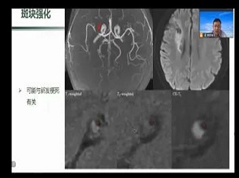 第九届神经脑疾病高峰论坛在我院召开